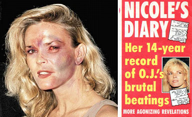 Nicole Brown Simpson beat up